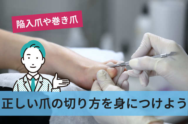 正しい爪の切り方を身につけよう