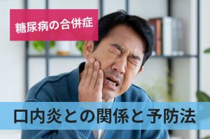 口内炎との関係と予防法