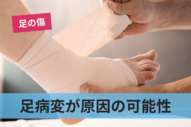 足病変が原因の可能性