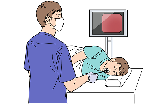胃カメラとは？